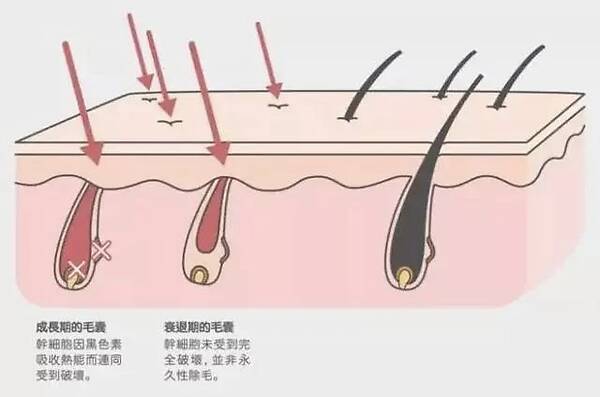 im电竞